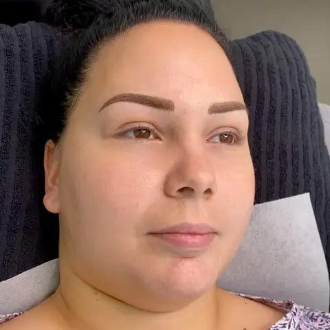 Microblading @mdbrowsau 🦋✨ Here is an excellent example of how we can all have fuller and beautiful brows with microbla - Melbourne Designer Brows